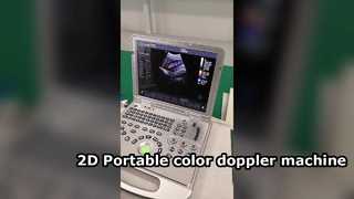 US15 Plus 2D Taşınabilir renkli doppler makinesi