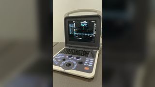 BR-US22 Ultrason makinesi