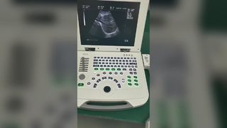 Tam dijital dizüstü bilgisayar Ultrason Teşhis Sistemi 80 element BR-US11