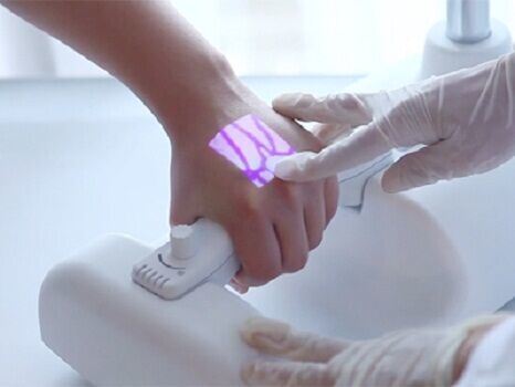 Vein finder machine