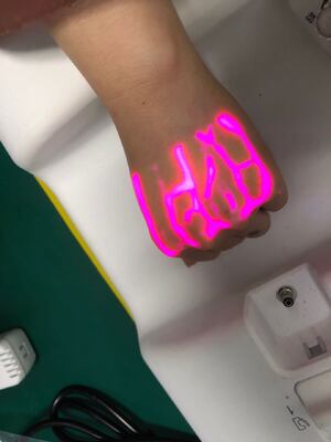 Vein finder machine