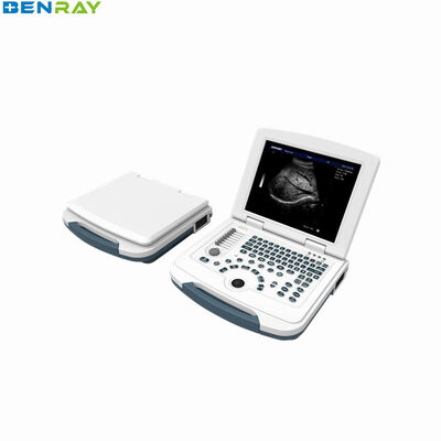 Full-Digital Laptop Ultrasound Diagnostic System 96 Element